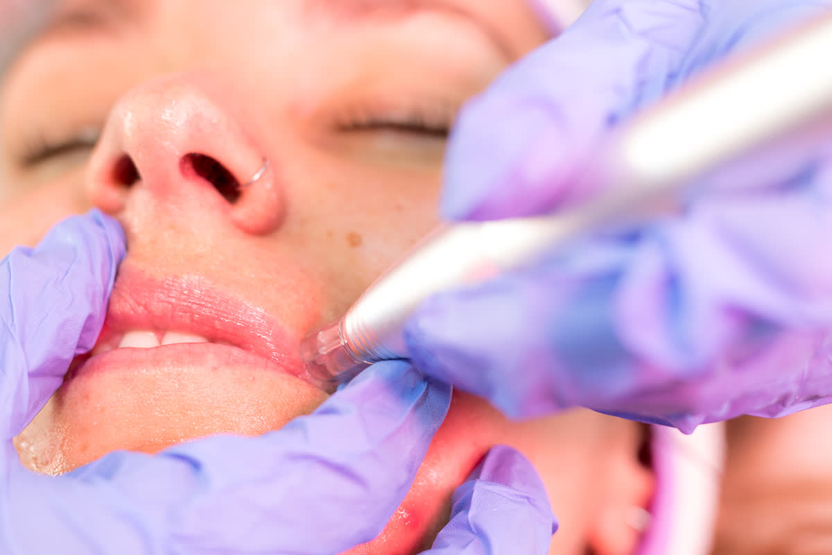 Aplicación de tratamiento corporal en Estética Geraldin
